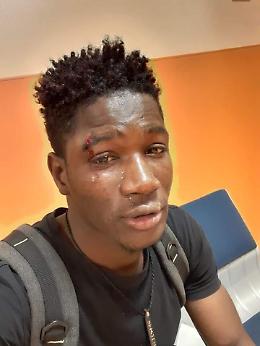 Aggressione razzista a Palermo,  5 identificati: 4 sono ragazzi