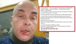 &laquo;Io picchiato dalla polizia di Malta&raquo;, la denuncia di un imprenditore siciliano