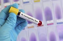 Bimbo di 4 anni di Mascali muore per sospetta meningite