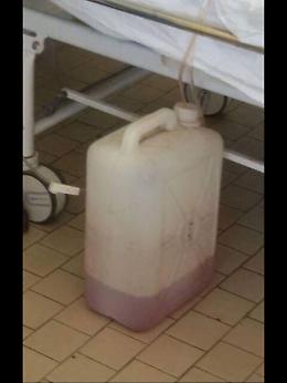 Siracusa, all'Umberto I per un lavaggio vescicale usato un bidone di plastica, inchiesta dell'Asp