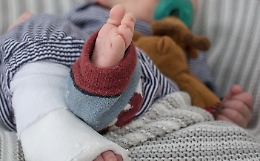 Bimba perde tre dita in ingranaggio bici, riattaccate