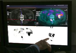 Arriva un'app per pazienti con tumore alla prostata