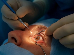 Catania, raffica di infezioni all'occhio dopo l'intervento per la cataratta: ci sono tre indagati, disposta la superperizia