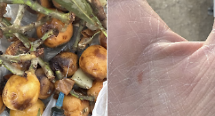 Incredibile a Vittoria, raccoglie l'organico e all'interno c'&egrave; una siringa che gli punge la mano
