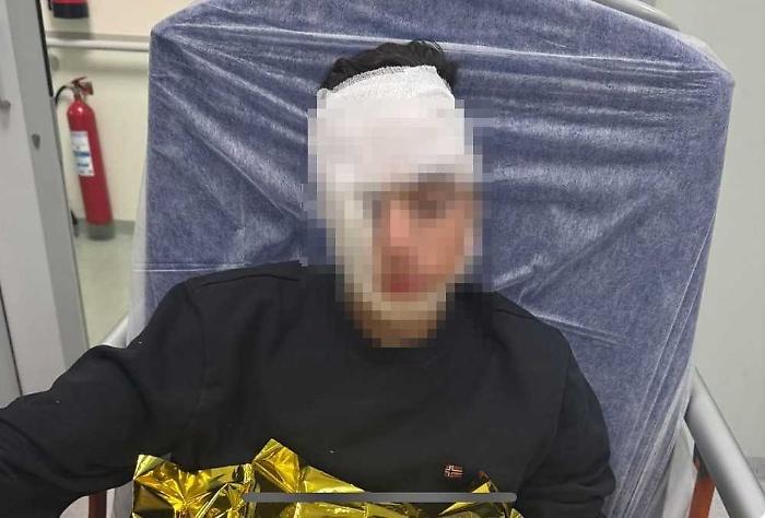 Ragazzino pestato da una baby gang in piazza Stesicoro a Catania: padre posta la foto e scatta l'appello per pi&ugrave; sicurezza